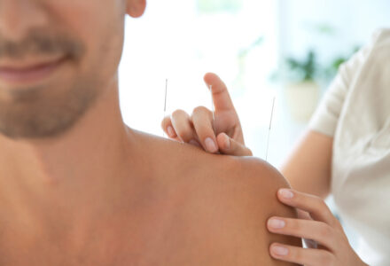 Berlin akupunktur gesundheitsleistung