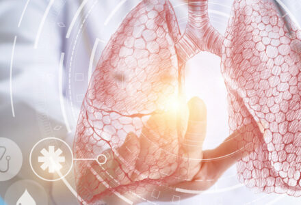 Policum feno messung igel