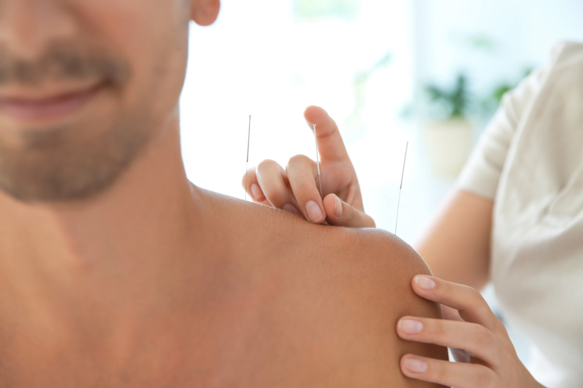 Berlin akupunktur gesundheitsleistung